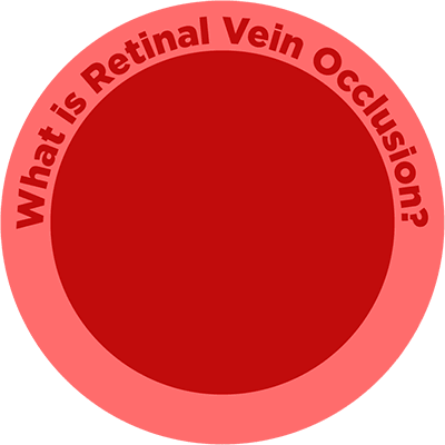 RVO_PWhat-is-RVO_Icon